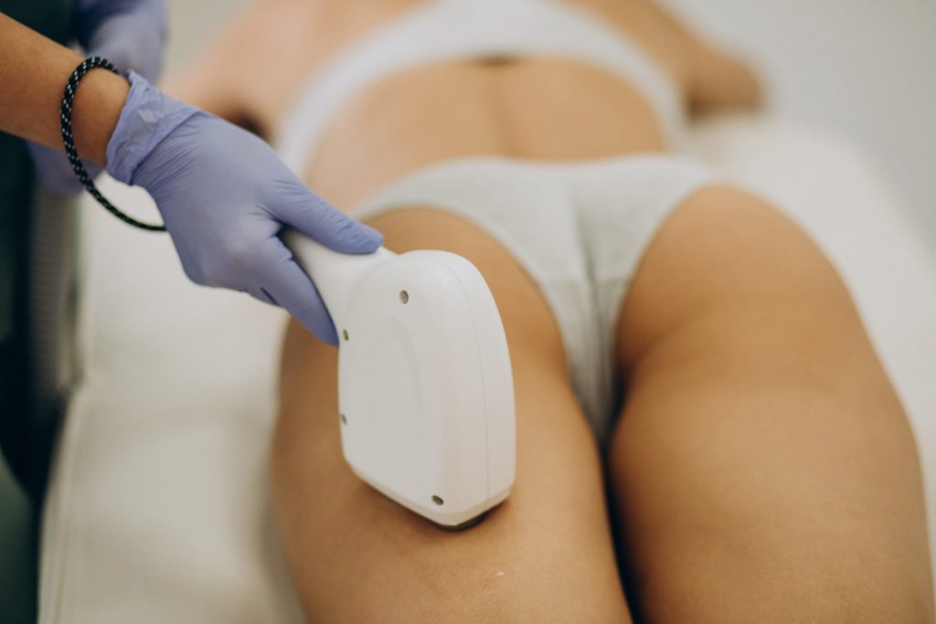 Prim-plan al unui tratament de epilare definitivă cu laser, în care un specialist aplică procedura pe piciorul unei femei.