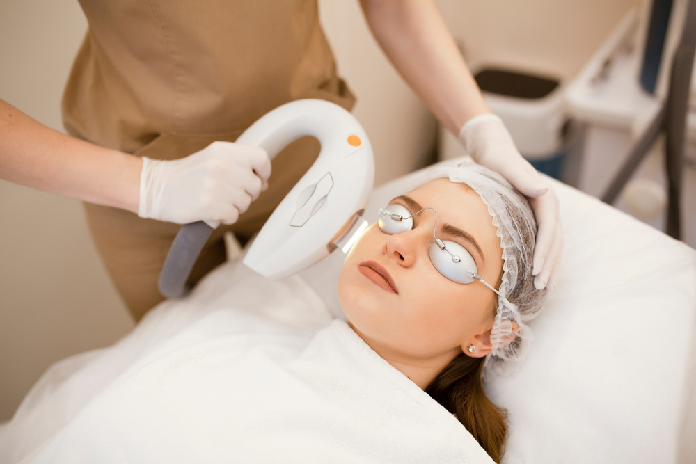 Epilarea IPL: O metodă eficientă și populară pentru îndepărtarea părului.
